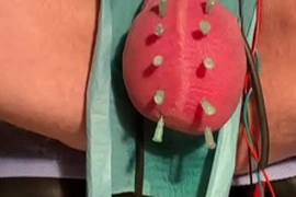 Final ballneedling in berlin