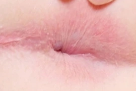 Closeup of my shaved asshole