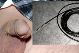 Curious Japanese guy tests UV camera to explore his peehole. Surprised to find unknown objects near urethra. Tries fiber scorp to remove, but micro scorp gets stuck, leading to intense, risky retrieval.