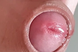 包皮翻開的瞬間