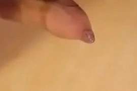 Phimosis cock great cumshot